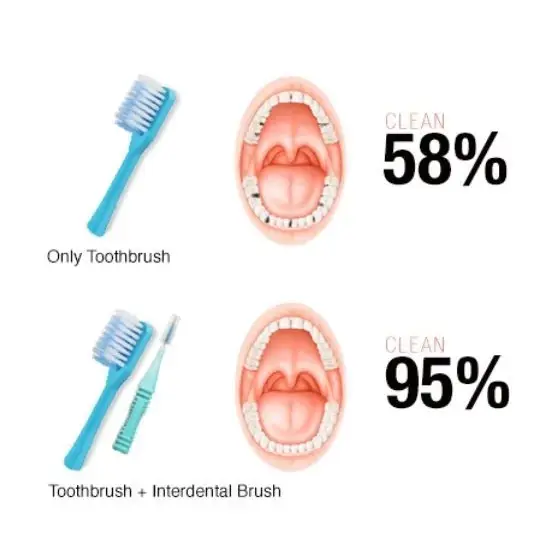 th-11134207-7ra0s-mdpqqnahwbfyc7 Dentalpro Interdental Brush " แปรงซอกฟัน " (มี Size 1,2,3) แปรงทำความสะอาดซอกฟัน